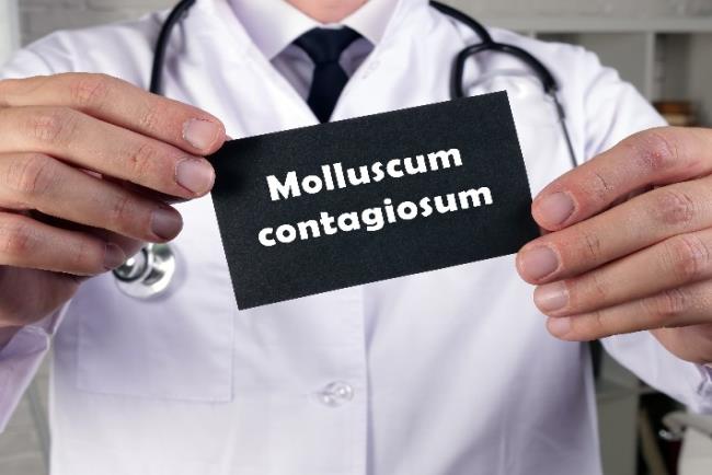 רופא מחזיק שלט ועליו כתוב מולוסקום קונטזיום - מחלת עור ויראלית מדבקת בעיקר בילדים